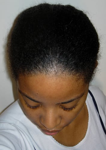 Posté par cheveux sauvages  sur 2006-05-20 13:09:05 
    Tagged:  , chignons , nattes , coiffures 
[ad_1]
[ad_2]…