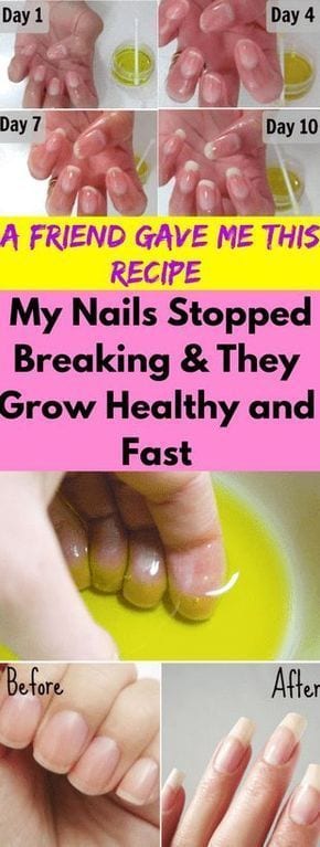 [ad_1]

A Friend Gave Me This Recipe and My Nails Stopped Breaking and They Grow Healthy and Fast – seeking habit
Source by amiekeveeren
[ad_2]
			
			…