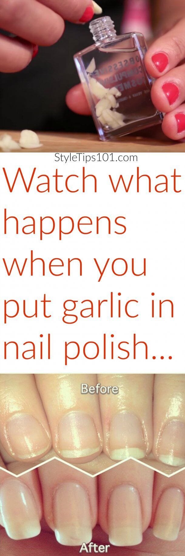 [ad_1]

Garlic in Nail Polish
Source by martajarosova78
[ad_2]
			
			…
