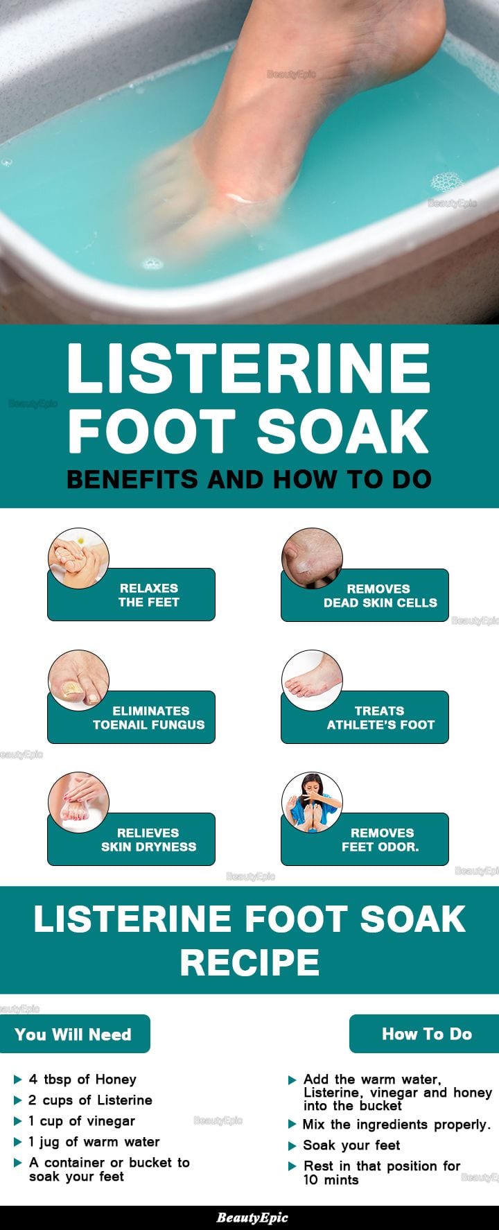 [ad_1]

Listerine Foot Soak Benefits and How to Do
Source by s9882
[ad_2]
			
			…