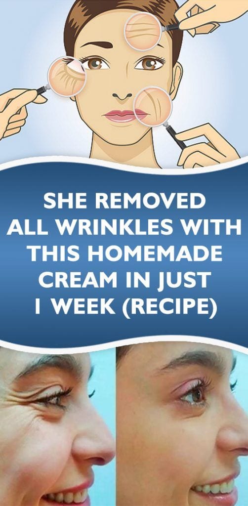 [ad_1]

She Removed All Wrinkles With This Homemade Cream In Just 1 Week (Recipe)
Source by Jodaan
[ad_2]
			
			…