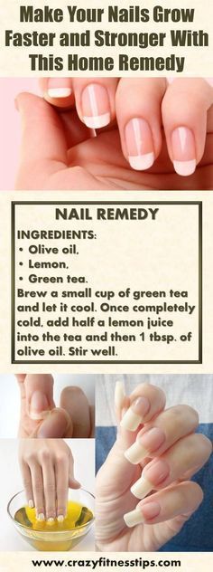 [ad_1]

Make Your Nails Grow Faster and Stronger With This Home Remedy #nailcaredesign #nailcaretreatment
Source by kaydenjess843
[ad_2]
			
			…
