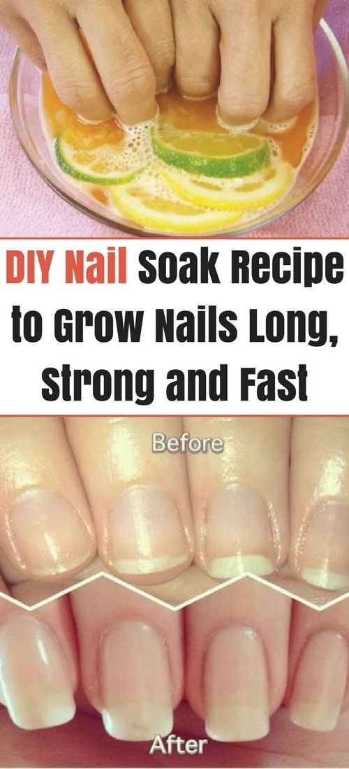 [ad_1]

This cheap and effective DIY recipe nail soak combines all natural ingredients that are tested and proven to make any nails grow stronger, longer, and overall healthier.
Source by ruthemery2
[ad_2]
			
			…